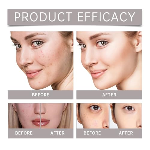 Nettoyant visage doux d'exception pour une peau lisse - 6