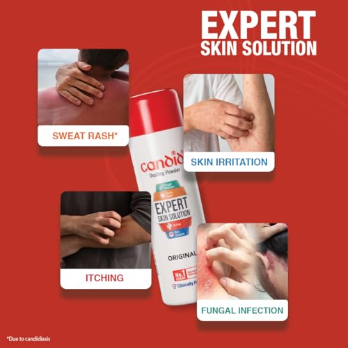 Image of Candid Dusting Powder | Doctor's Prescribed No.1 Brand | Prevents & Treats Fungal Infection, Sweat Rash, Itching, Redness & Skin Irritation | Clinically Proven | 120g