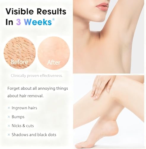 Image of IPL Laser Hair Removal Device for Women and Men - Permanent Painless 90% Hair Reduction in 4 Weeks, Whole Body Use (Armpits, Bikini Line, Face, Legs, Arms, Back) - Corded At-Home