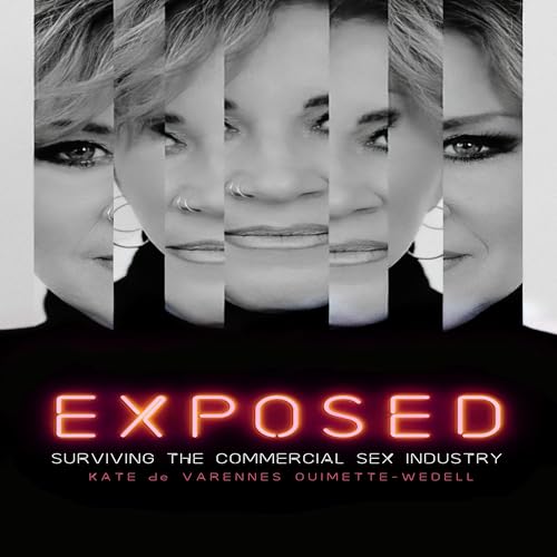『Exposed』のカバーアート