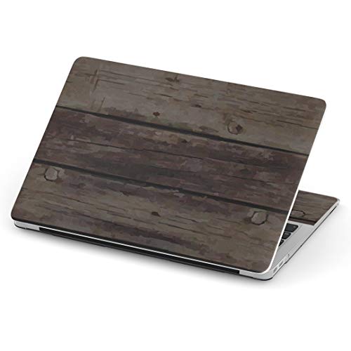 igsticker Macbook Pro 13inch 2020/19/18/17/16 pXLV[ A1989 / A1706 / A1708 }bNubN v 13C` pV[ tB XebJ[ ANZT[ ی 000371 