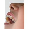 Apa Care Mineralizing Tooth Paint with 20% Medical Hydroxyapatite (Liquid Enamel) Shellac Based Self-Hardening Brush Bottle 5 ml