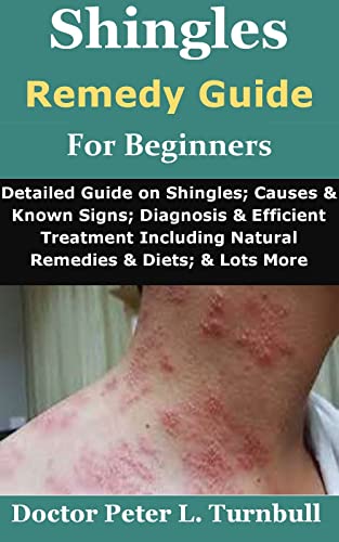 Shingles Remedy Guide for Beginners: Detailed Guide on Shingles; Causes & Known Signs; Diagnosis & Efficient Treatment Including Natural Remedies & Diets; & Lots More