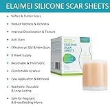 mysemgshuo B0FBVXY67Z lato 3