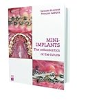 Mini-Implants: The orthodontics of the future Mini-Implants: The orthodontics of the future