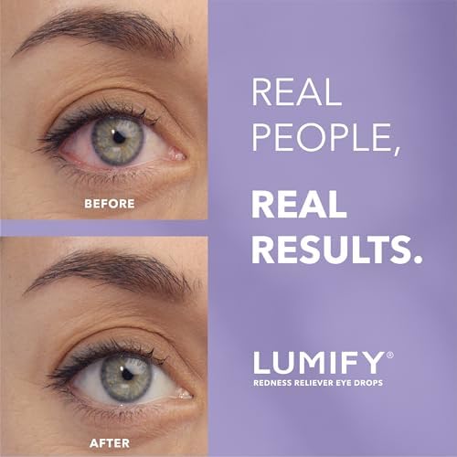 LUMIFY Eye Drops for Red Eyes, Redness Reliever for Brighter Looking Eyes, Works in 1 Minute & Lasts Up to 8 Hours, Eye Drops, 0.08 Fl Oz (2.5 mL) - thumbnail 2