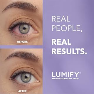LUMIFY Eye Drops for Red Eyes, Redness Reliever for Brighter Looking Eyes, Works in 1 Minute & Lasts Up to 8 Hours, Eye Drops, 0.25 Fl Oz (7.5mL)