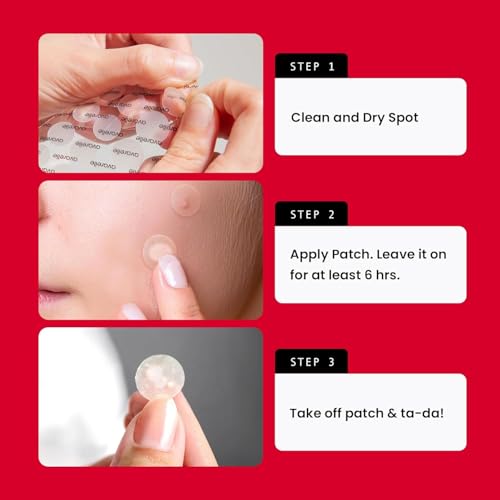 Avarelle Acne Pimple Patch (40 Count) Variety Pack — view 7