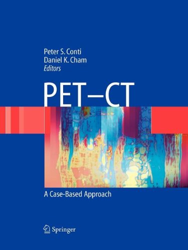 PET-CT: Bartknecht, Wolfgang: 9780387501000: Amazon.com: Books