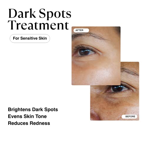 Matkas Korean Dark Spot Remover For Face & Body Serum + Niacinamide + Oat Extract For Deep Correcting Uneven Skin Tone, Brightening Hyperpigmentation Treatment, Dark Spot Corrector Lightening Cream #TOP1