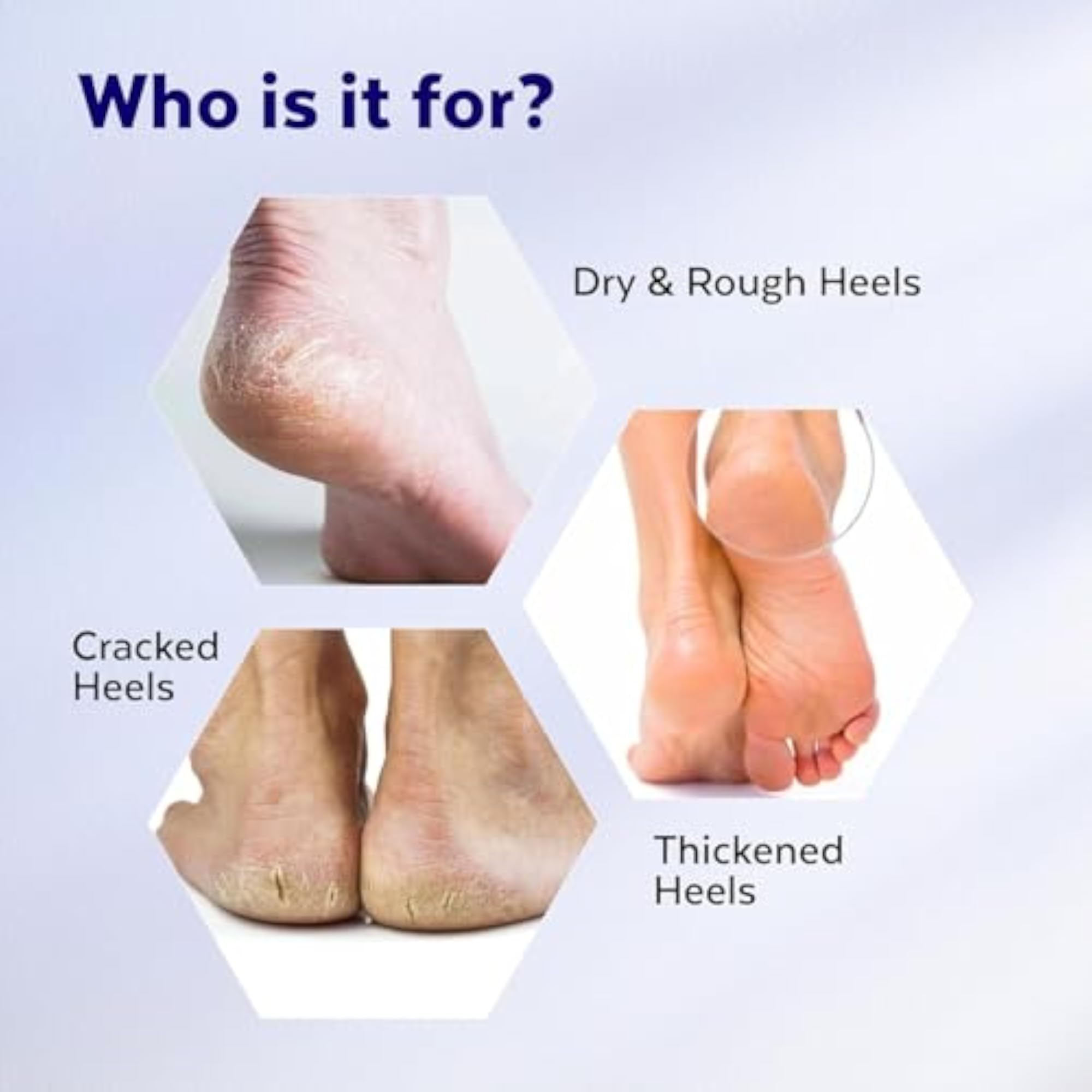 Moisturizing Silicone Gel Socks with Foot Cream Roll On