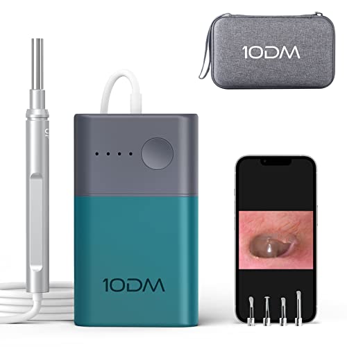 Top 10 Best Digital Otoscope For Iphone Reviews & Buying Guide Katynel