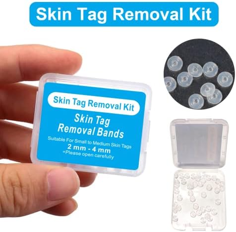 Skin Tag Remover Kit - 20Pcs Skin Tag Removal Rubber Bands Large Size (5mm-8.5mm) & 20Pcs Skin Tag Removal Bands Small to Medium Sized (2mm-4mm) & 40Pcs Alcohol Pads (A 20+20+40)