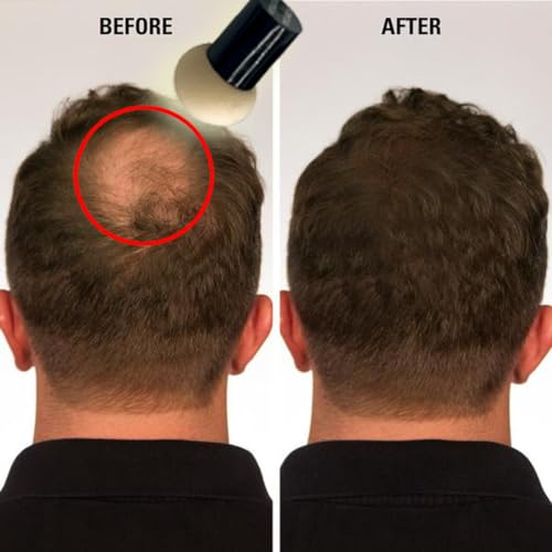 KERATIN RESEARCH Hairline Filler Unisex Mineral Powder Root Touch-Up Hair loss Concealer Scalp & Beard Bald Patch Coverage Fibers for Thinning Hair Waterproof Organic Natural Results (DARK BROWN, XL)