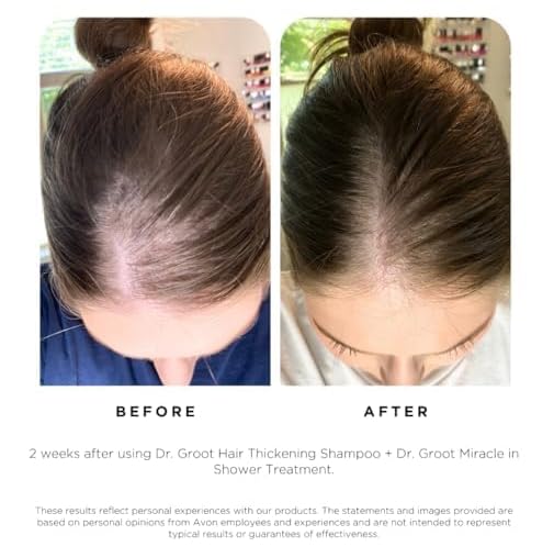 Miniatura 5 de Dr. Groot Champú calmante para el cuero cabelludo con biotina, centella y prebióticos, solución hidratante de Kbeauty para cuero cabelludo seco,