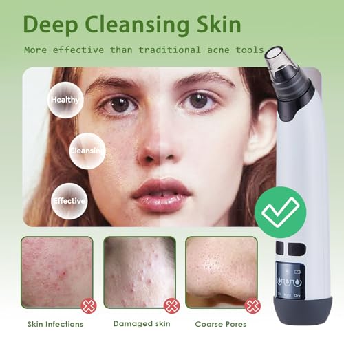 Xamoca XHTY-001 Blackhead Remover Vacuum - Black Head Remover For Face,Blackhead Extractor Tool With 3 Adjustable Suction Levels,4 Probes,Usb Interface Type Pore Vacuum,Suitable thumb #4