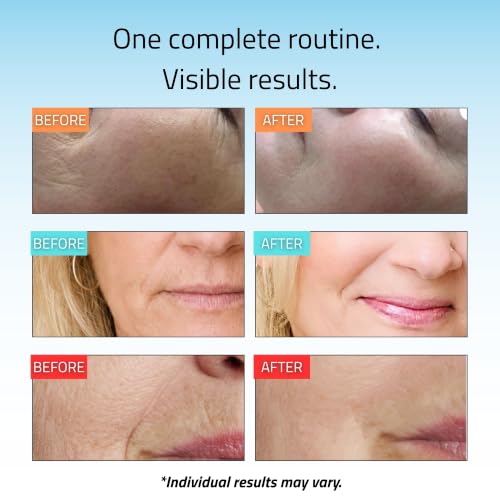 YEOUTH 8-Piece Full Size Skin Care Set for Visibly Smoother-Looking Skin | Face Serum Set with Retinol, Vitamin C, and Pure Hyaluronic Acid Serum for a Complete Day and Night Routine