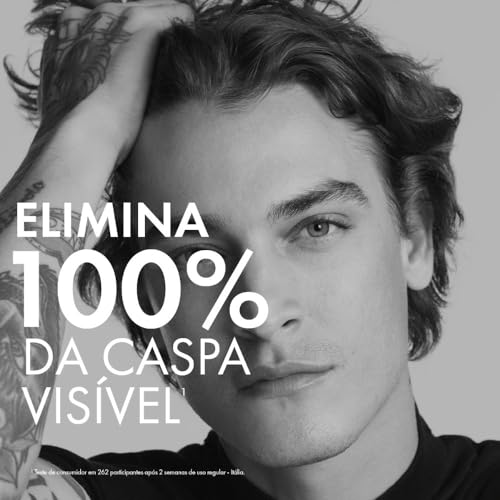 Vichy, Dercos Shampoo Anticaspa Intensivo para Cabelos Secos, 300ml