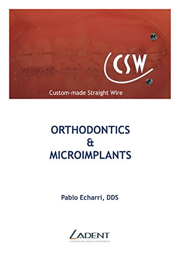 ORTHODONTICS & MICROIMPLANTS