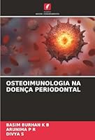 Osteoimunologia Na Doença Periodontal (Portuguese Edition) 6200727538 Book Cover