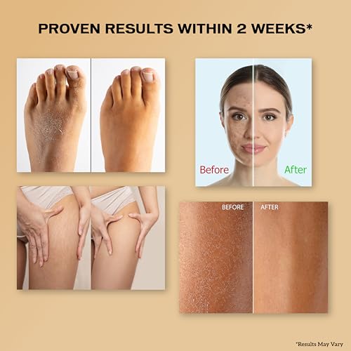 Image of inatur Coffee Body Scrub - Exfoliating, Brightening Tan Removal & Hydrating | With Niacinamide, Salicylic & Glycolic Acids | Cruelty-Free, Vegan & Sulfate-free Formula | 200g