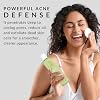 Double O Complex Astringent by Flori Roberts, 20% Salicylic Acid for Acne Prone Skin, Helps Clear Acne Blemishes, Facial Cleanser for Pimples