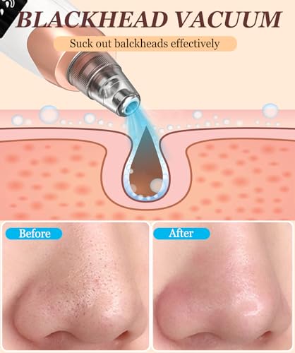 Blackhead Remover Vacuum 3 Suction Power Mode Blackhead Remover Tool with 5 Suction Heads Blackhead Extractor Rechargeable Comedone Extractor,Pore Vacuum Whitehead Remover Suitable for Women and Men - Image 6
