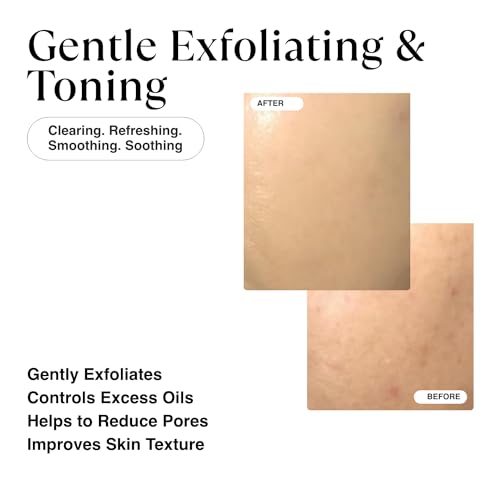 MATKAS Korean Exfoliating Toning Pads for Oil Control, Unclogging Pores, Blackheads, Uneven Skin Tone, Texture - Glycolic Acid, Lactic + Salicylic Acid, Witch Hazel Extract, Korean Toner Pads 60 - Image 3