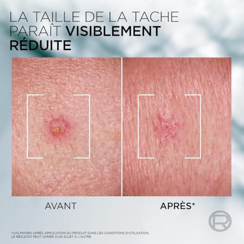 Soin Visage Homme Derma Control Pâte Sos Anti Imperfections Men Expert Le Flacon De 45ml - vue 5