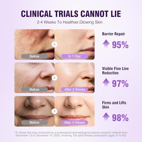 Image of Retinol Peptides Serum for Face: Anti Aging NAD+ Firming Collagen Serum for Wrinkles Fine Lines, Hydration Face and Neck Skin for Women Men Day Night