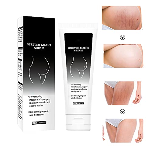 Upgrade Stretch Mark Scar Cream,Remove Pregnancy Scars,Stretch Marks and Scar Removal Cream for Pregnancy,Repair Scar Slackline Abdomen Stretch Marks Postpartum