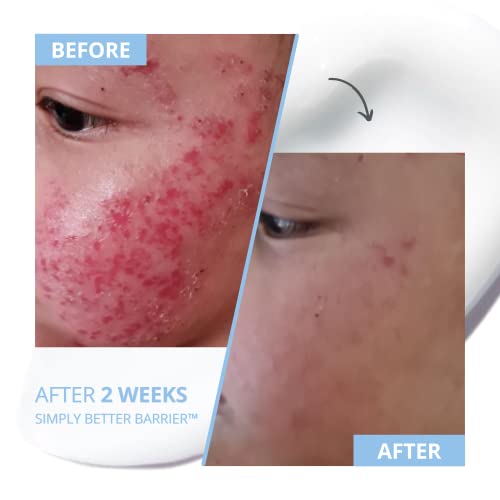 Kansoskin Simply Better Barrier Hydrating Relief Cream, Soothes Eczema, Dry, Red, Itchy And Sensitive Skin, Low-Ph, Vegan, Gentle, Fragrance-Free, Repair Moisturiser For Face And Body, 60Ml #TOP3