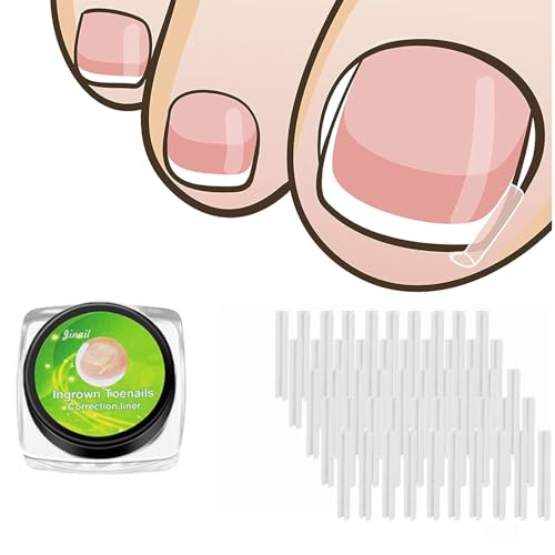 Toenail Corrector Strips, Ingrown Nail Corrector, Toe Nail Corrector Strip with Gentle Adhesive, 50 Pcs Breathable Patches for Daily Nail Support and Comfort