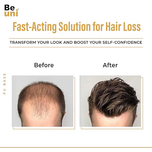 Image of Skin Base Hair Toupee For Men With 100 Percent European Hair 0.03mm PU Thin Skin V Loop Hair Replacement System Natural Look Black 9x7 Inch