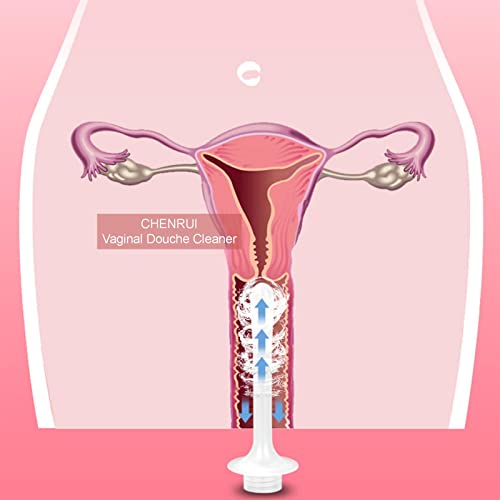 Vaginal Cleansing Douche, Reusable Vaginal Syringe Cleaner For Puerpera Period #TOP3