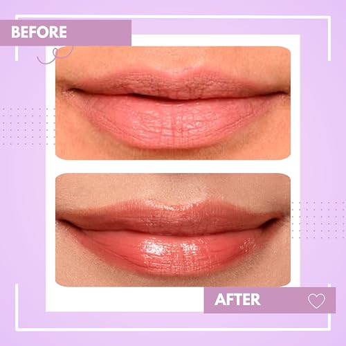 Image of TEE ESS Unisex Strawberry Lip Balm | Hydrating & Plumping Lip Care with Vitamin E, Shea Butter, Jojoba Oil | 4 gms