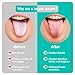 VIWIK 6 Pack Tongue Scraper for Adults, 100% Stainless Steel Tongue Cleaner - Hygienic Oral Care Tools, Bad Breath Remover Tongue Brusher