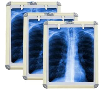 MEDIGUARD X-Ray View Box LED Illuminator Radiology (Automatic Single ...