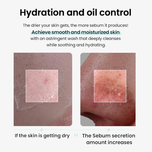 ilso Super Melting Sebum Cleansing Oil Watery Facial Cleanser