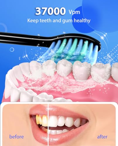 Beutxia 101 Sonic Electric Toothbrushes For Adults, 8 Brush Heads Electric Toothbrush With 37000 Vpm Deep Clean 6 Modes 18 Gear, Rechargeable Toothbrushes Fast Charge 4 Hours Last 50 Days thumb #1