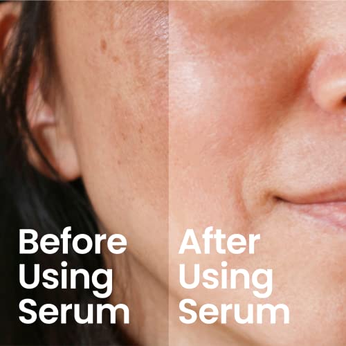 PORTION Retinol Face Serum, Anti Aging Serum for Face: 0.3% Retinol & 2% Bakuchiol - Image 4