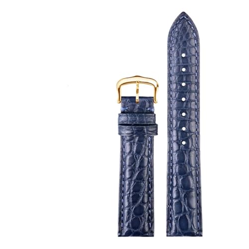 [-ł] 16/17/18/20mm NR_CEHb`ohuXbg JeBG h \V[Y Y fB[X U[EHb`XgbvΉ(Blue gold pin,16mm-width)