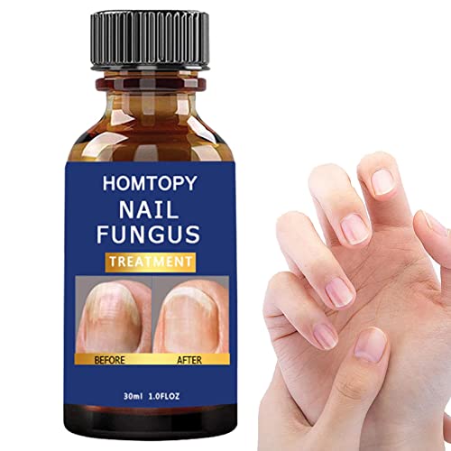 JINGAN Fortalecedor de uñas, Kit de reparación de uñas para uñas Naturales agrietadas, El endurecedor de uñas Protege Las uñas de astillas, rajaduras, peladuras y roturas para uñas Finas y agrietadas