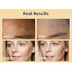 Advanced Snail 96 Mucin Power Essence, Hydrating & Moisturizing Face Serum For Women, Snail Secretion Filtrate Moisturizer, Soothing & Calming Facial Serums, Anti-Aging Repair For Dry Dull - Image 3