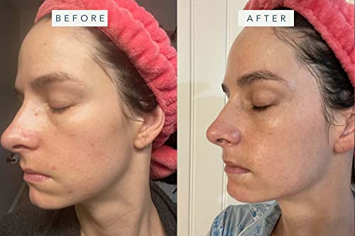 Brandefy Daily Triple - Niacinamide Serum, Peptides And Hyaluronic Acid. Hydrating & Plumping Serum For Bright, Smooth, Firm & Dewy Skin, 1.7Oz, Made In The Usa #TOP4