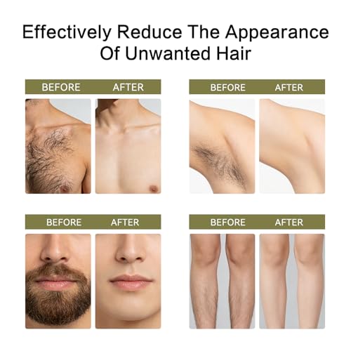 LHOPEBK Nature Cyperus Rotundus Oli for Hair Removal: 100% Pure Natural for Reducing Body Hair 60s Quick Absorption Shrinking Pores Prevents Ingrown Hairs Moisturizing & Soothing for All Skin Types