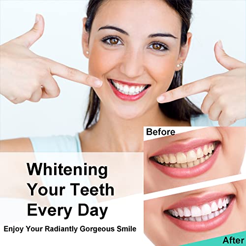 Led Teeth Whitening Light, Tytca Teeth Whitening Accelerator Light With 16X More Powerful Blue Led Light Connected With Iphone/Android/Usb For Home Use Helps Effectively Remove All Kinds Of Stain #TOP4