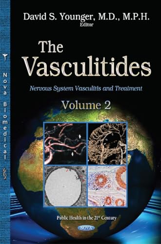 The Vasculitidiesnervous System Vasculitis & Treatment Volume 2