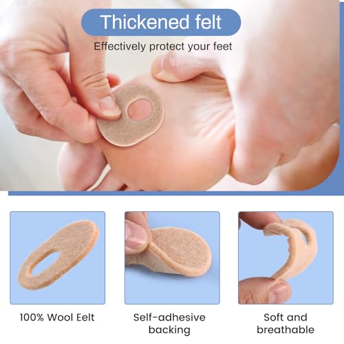 Image of 24Pcs Callus Pads，Soft Felt Callus Oval Shape Cushion Pads for Toes and Feet, Reduce Pain, Pressure and Friction from Shoes