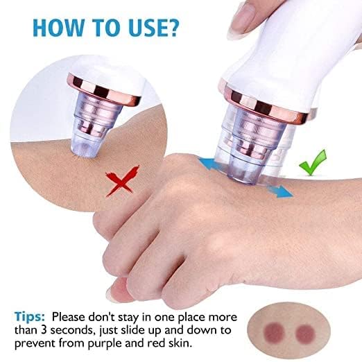 DOZERA Beautiful Skin Care Expert Acne Pore Cleaner Vacuum Blackhead Remover Kit Skin Cleaner, Pimple Removal Tool, Acne Removal Tool, Blackhead Remover Tool 4